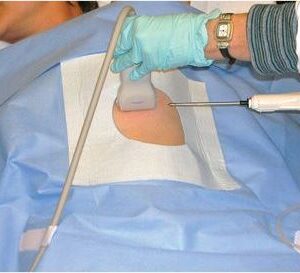 Biopsy Drape